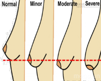 3 công thức giúp nâng cấp bộ ngực chảy xệ trên cả tuyệt vời