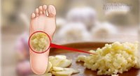 Bài thuốc chữa ho nặng mấy cũng khỏi
