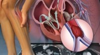 Dấu hiệu ở chân cảnh báo bạn đang mang bệnh nguy hiểm