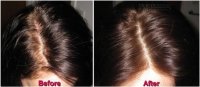 Tuyệt chiêu hết rụng tóc, mọc như nấm sau 2 lần ủ thứ này