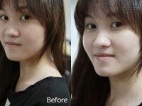 Mách bạn 3 cách tắm trắng cấp tốc cực hiệu quả trong mùa đông