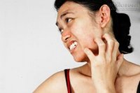 Làm thế nào để chiến thắng cơn ngứa mà không cần gãi?