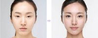Hô biến mắt sụp mí thành mắt 2 mí trong tích tắc