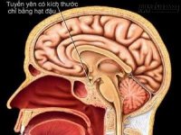 Trên mắc bệnh, dưới chịu hậu quả