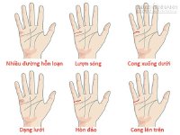 Các dạng đường hôn nhân thường gặp và ý nghĩa của chúng