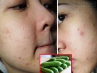 Những sai lầm không thể cứu vãn khi đắp mặt nạ dưa chuột sai cách
