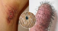 99% người không biết hậu quả khôn lường của việc nhổ lông vùng dưới cánh tay