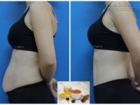 Uống loại nước này trước khi ngủ, sau 10 ngày bụng sẽ phẳng lì