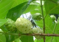 Có 5 thứ này trong nhà thì chắc chắn bạn không bao giờ bị đau lưng nữa