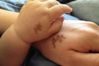 Biết ngay người lòng lang dạ sói chỉ cần xem vết bớt trên cơ thể