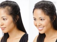 Hói đầu: ủ hỗn hợp này, tóc mọc dày trở lại ngay