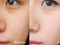 Se khít lỗ chân lông thật dễ dàng nhờ … nước