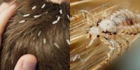 Phát hoảng với những kí sinh trùng hút máu ở rất gần bạn