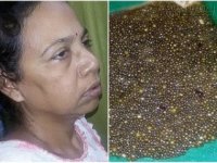 Những ca bệnh sốc bạn không tin nhưng có thật trong năm qua