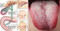 Đây là 9 lý do cơ thể cần được giải độc ngay sau khi đọc được bài này