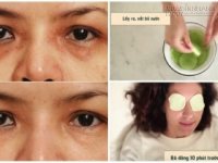 Sở hữu đôi mắt rạng ngời, hết quầng thâm với những mẹo dễ không tưởng