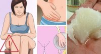 Nếu có những triệu chứng này, cô bé đã bị nhiễm nấm ở mức đáng báo động rồi đấy