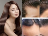 Hỗn hợp thần kỳ giúp tóc mọc ầm ầm ngay sau khi sử dụng