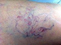 9 dấu hiệu cho thấy gan bạn đang hư hỏng nặng mọi người đừng bỏ qua