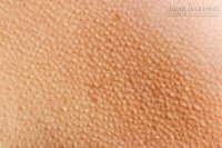 Nhức đầu, rụng róc, chuột rút mãi không hết, kiểm tra các điều sau