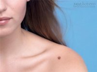 Nếu có vết bớt này, đảm bảo bạn sẽ được cả đời sung sướng