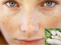 Loại củ quả quen thuộc mà bạn không nghĩ sẽ trị được nám