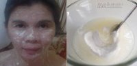 Đánh tan những nốt mụn xấu xí, da trăng tinh khôi với 4 bí quyết cực đơn giản