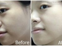 Dưỡng da trắng không tì vết với nguyên liệu ai cũng bỏ đi