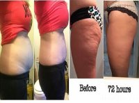 Có mẹo giảm cân trong 72 giờ, ăn Tết thật no chẳng lo béo bụng