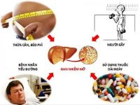 Bệnh gan nhiễm mỡ cách chữa đơn giản nhưng hiệu quả