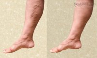 Nếu có những dấu hiệu này trên da, hãy sử dụng ngay phương pháp này