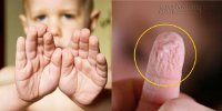 Vì sao da tay bạn thường nhăn sau khi tắm?