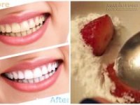 Chỉ cần chà thứ này là răng trắng sáng, nụ cười tỏa nắng đón Tết thêm xinh