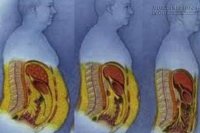 Tống khứ mỡ bụng và hết táo bón nhờ uống 2 muỗng này mỗi ngày