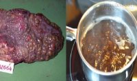 Giải độc gan trong 2 ngày dù cho Gan bạn nhiều năm bị rượu bia bào mòn
