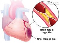 Trị chứng tâm dương hư ở người cao tuổi