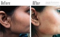 Da mịn hết mụn và sạch lông mặt nhờ bí truyền từ Trung Đông