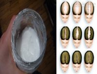 Vứt dầu gội đi, baking soda và giấm giúp tóc mọc khỏe hơn nhiều