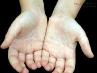 Hình dáng rìa lòng bàn tay bật mí nhân cách con người