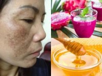 Loại quả này có thể giúp bạn trị nám trắng da ngay tức thì