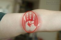 Vỗ vào lõm khuỷu tay, tuyệt chiêu cứu bệnh nhân lên cơn đau tim