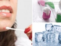 Bí quyết đánh bay nốt mụn đáng ghét chỉ sau 1 đêm