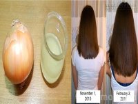Tóc mọc dày và dài cấp tốc bằng cách sử dụng công thức đơn giản này