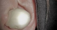 Đầu đau buốt như búa bổ sẽ hết ngay với cách này