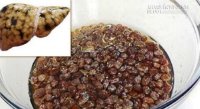 Mỗi năm, tất cả chúng ta nên thải độc gan 2 lần với nho khô