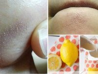 Thoa thứ này, mụn li ti ở cằm và hai bên cánh mũi sẽ bị loại sạch chỉ sau 15 phút