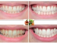 4 cách giúp răng miệng luôn sáng bóng và thơm mát bạn nên bỏ túi ngay