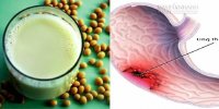 Thực hư chuyện uống sữa đậu nành gây bệnh ung thư