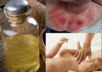 Bí quyết trị hăm tã bằng dầu dừa giúp da trẻ trơn láng ngay sau một đêm