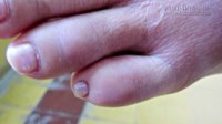 Thấy 1 trong 7 biểu hiện này thì bạn hãy tới bác sỹ ngay lập tức